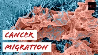 EX Cancer Invasion through Extracellular Matrix [upl. by Ardnekan793]