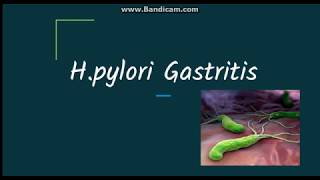 What is a H Pylori Helicobacter Pylori Infection [upl. by Nitsej]