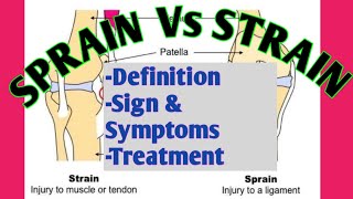 Strain Vs Sprain [upl. by Melessa]