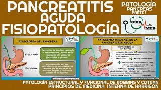 PANCREATITIS AGUDA FISIOPATOLOGÍA  GuiaMed [upl. by Akihsar]