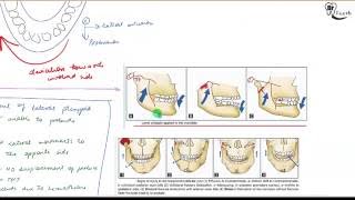 Supracondylar Fracture of Humerus  Orthopedics [upl. by Anastasio671]