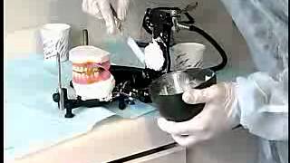 Complete Denture Procedure  21 CLINICAL REMOUNT AND OCCLUSAL REFINEMENTS [upl. by Atteuqaj]