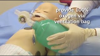 Endotracheal intubation part 6 Confirming the ETT depth with CXR [upl. by Ettelloc]