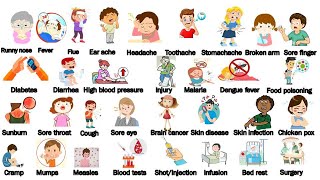 Illnesses and Treatments In English  Health and Diseases Vocabulary [upl. by Relyuhcs753]