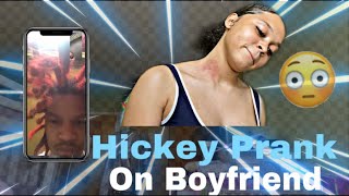 Hickey Prank On Boyfriend He Went Crazy [upl. by Lewellen71]