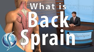 What is a Back Sprain [upl. by Abih107]