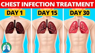 7 Natural Chest Infection Treatments Home Remedies [upl. by Franci]