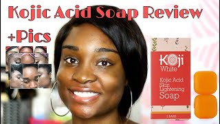 SKIN LIGHTENING SOAP Koji White Kojic Acid Skin Lightening Soap Review  BeautyByAJ [upl. by Jona]