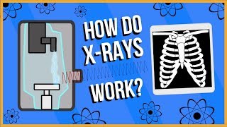 How do XRays Work [upl. by Moritz824]