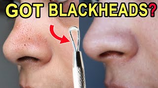 How I Clean Congested Pores on the nose you should have one at home [upl. by Hamimej]