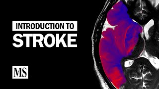 What Causes a Stroke [upl. by Halimaj]