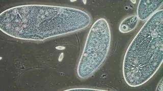 Paramecia Contractile Vacuoles by Edwin Lee [upl. by Ebag957]