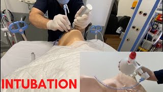 EXTUBATION REMOVING AN ETTARTIFICIAL AIRWAY [upl. by Lyret]