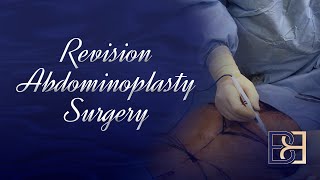 Revision Abdominoplasty Surgery  2020 [upl. by Romina]