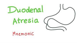 Duodenal Atresia Mnemonic [upl. by Atinel670]