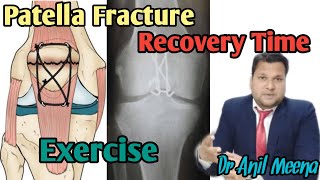 Fracture Femur Types  Everything You Need To Know  Dr Nabil Ebraheim [upl. by Adelbert500]