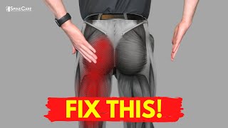 The QUICKEST Way to Get Sciatic Leg Pain Relief [upl. by Bertha]