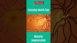 Macular edema Central Retinal Vein Occlusion [upl. by Ally]