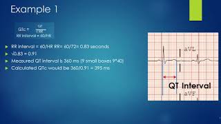 How to properly calculate a Qtc [upl. by Jordison]