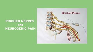 Pinched Nerves and Neurogenic Pain [upl. by Ardnoid42]