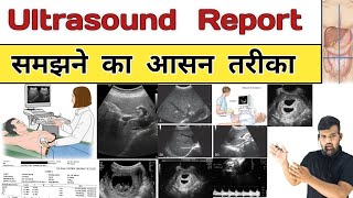 Follicular monitoring क्या होती है  Sonal Parihar [upl. by Peterson]