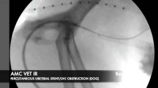 Interventional Radiology Percutaneous Ureteral Stent [upl. by Ellecrad]