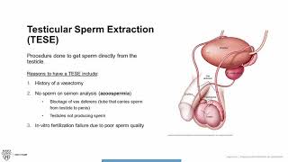 Testicular Sperm Extraction TESE Procedure Overview [upl. by Akihsat524]