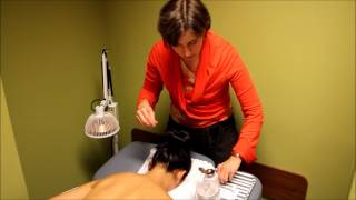 Acupuncture Demonstration and Benefits [upl. by Naraj980]