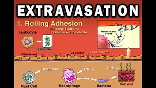 EXTRAVASATION [upl. by Haily]