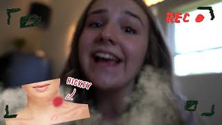 HICKEY PRANK ON BOYFRIEND He Freaked Out EMOTIONAL REACTION🔥💋 Piper Rockelle [upl. by Adnalohs189]