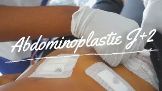 Abdominoplastie VLOG 3 JOUR J2 😱 JE MONTRE TOUT [upl. by Nomyar]