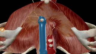 Les orifices du diaphragme [upl. by Asirrom]