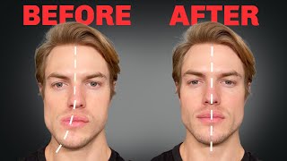 How to Fix Asymmetrical Jaw amp Face FOREVER [upl. by Enial]