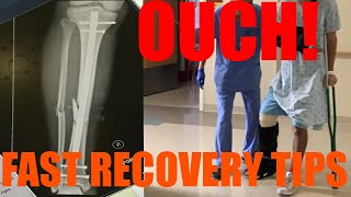 How to Recover Quickly From Broken Leg Fractured Tibia  Fibula ORIF Surgery [upl. by Leontina228]