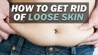 How To Get Rid Of Loose Skin After Losing Weight [upl. by Lotus]