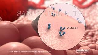 Understanding Immunoglobulin Therapy [upl. by Twelve]