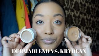 VITILIGO COVERAGE  DERMABLEND VS KRYOLAN MAKEUP [upl. by Dom]