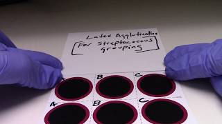 Latex Agglutination FOR Streptococcus Grouping [upl. by Lothario153]