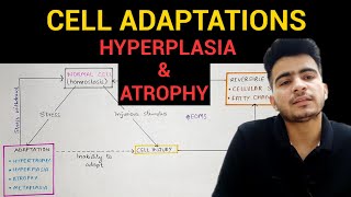 Hyperplasia amp Atrophy  Cell Adaptations 23  General Pathology  EOMS [upl. by Malachy]