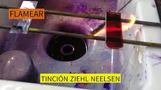 TINCION ZIEHL NEELSEN [upl. by Allissa124]