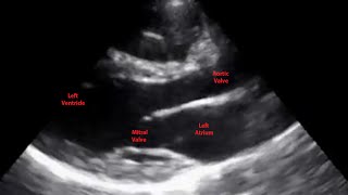 Echocardiogram Parasternal Long Axis View  Loop [upl. by Artkele683]