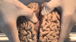 Introduction Neuroanatomy Video Lab  Brain Dissections [upl. by Acissj538]