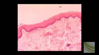 SLIDE Stratified Squamous Epithelium [upl. by Elliott]