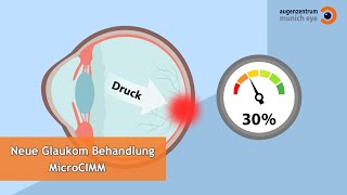 Lasertherapie bei Glaukom MicroCIMM  MUNICH EYE [upl. by Lamdin752]