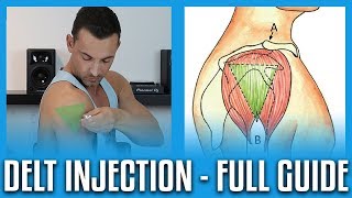 How To Do A Deltoid Injection  Full GuideDemo [upl. by Nivrag385]