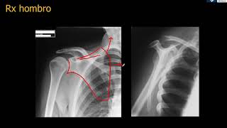 Anatomía Rx Hombro [upl. by Woothen]