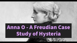 Anna O  A Freudian case study of Hysteria and the Electra Complex [upl. by Keon451]