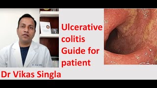 Ulcerative Colitis आँतों के घाव  Treatment with Ayurveda  Swami ramdev [upl. by Scharf865]