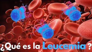 ¿Qué es la Leucemia [upl. by Rikahs]