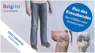 Kreuzbandriss operative Behandlung vordere Kreuzbandruptur [upl. by Aholla224]